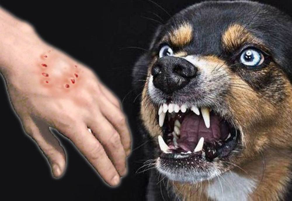 โรคพิษสุนัขบ้า เกิดได้ทั้งคนและสัตว์จริงหรือ?