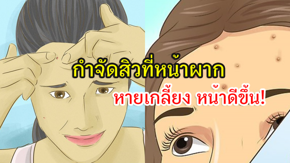 สิวที่หน้าผาก ใส่ Mask ยังไงก็เห็นอยู่ดี รวม วิธีรักษาสิวที่หน้าผาก ให้หายขาด