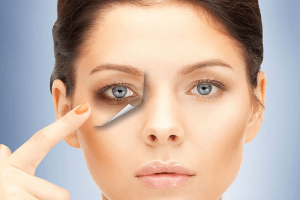 10 วิธีบอกลาปัญหาความหมองคล้ำรอบดวงตาพร้อม บำรุงรอบดวงตา