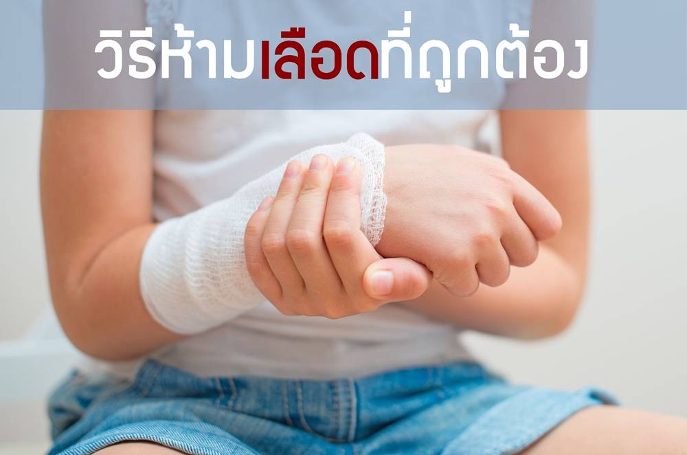 เลือดไหลไม่หยุด มีวิธีแก้! รวม วิธีห้ามเลือด ที่ถูกต้องและรวดเร็วทันใจ